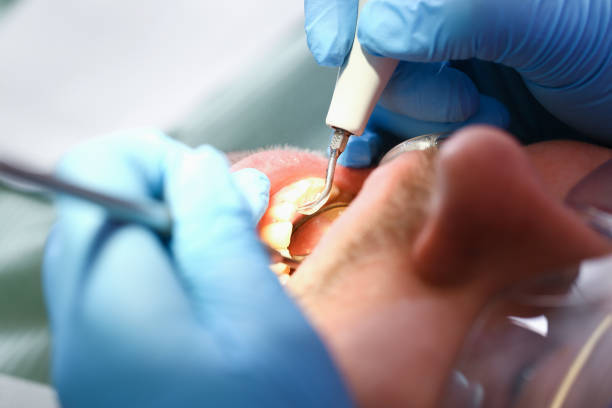 Best Dentist Open on Weekends  in Longbranch, WA